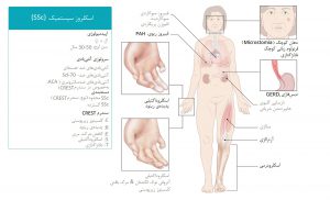 نکات کلی به اسکلروز سیستمیک
