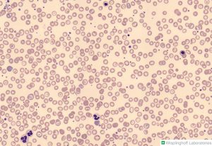 Target cell