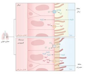 پاتوفیزیولوژی سیستیک فیبروزیس