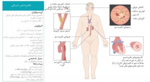 نکات کلی فشارخون بالا