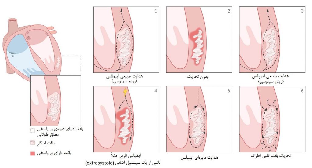 مکانیسم ورود مجدد قلبی