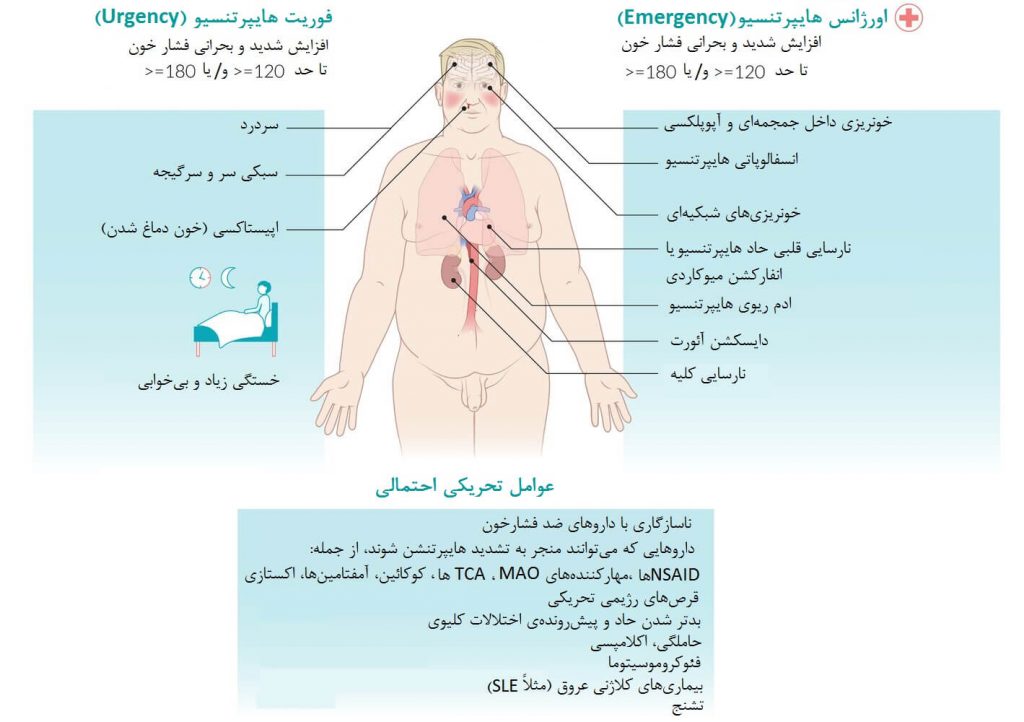 نکات کلی بحران هایپرتنسیو