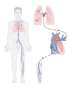 پاتوفیزیولوژی آمبولی ریوی