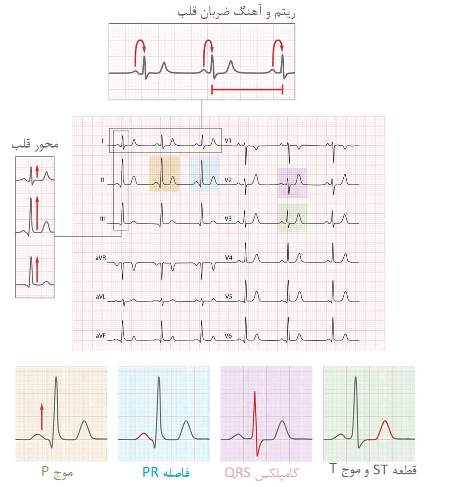 چگونه یک ECG را بخوانیم