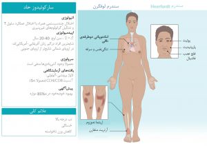 نکات کلی سارکوئیدوز حاد