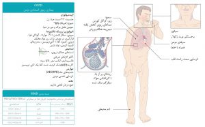نکات کلی بیماری COPD