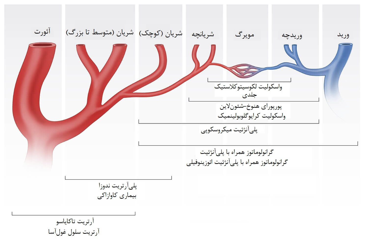 انواع واسکولیت‌ها