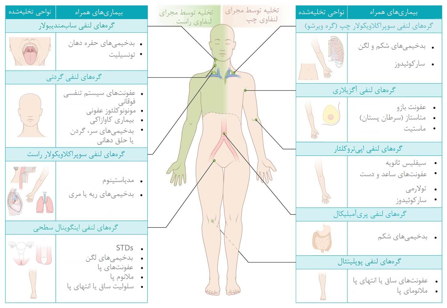 گره‌های لنفی قابل لمس